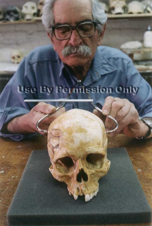 Dr. Charney measures a skull.