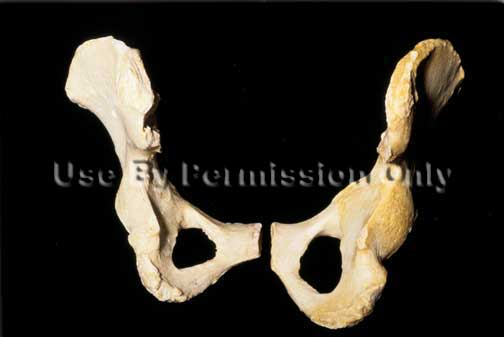 A female pelvic bone (left) is wider than a male\'s (right) to make deliveing a baby easier.