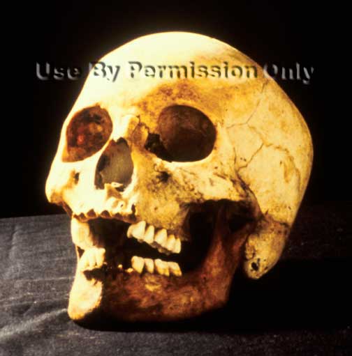 Victim\'s skull