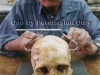 Dr. Charney measures a skull.